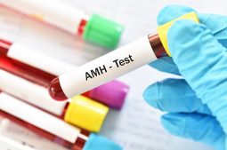 Low AMH Levels: understanding the impact on fertility