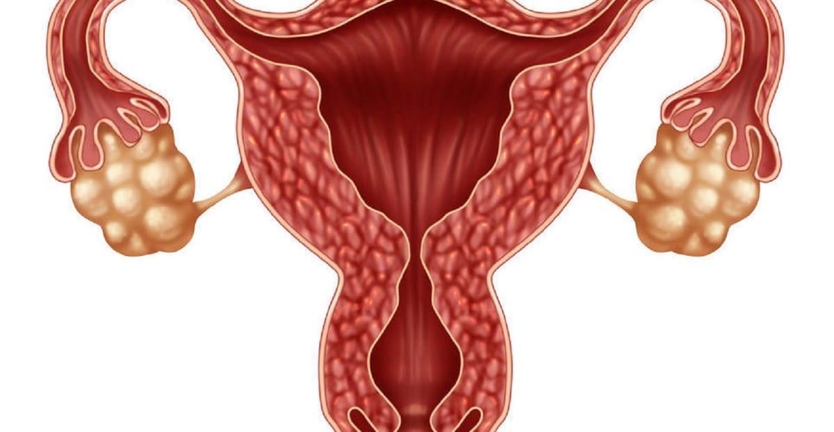 is-an-ovarian-follicle-a-cyst-ivi-fertility