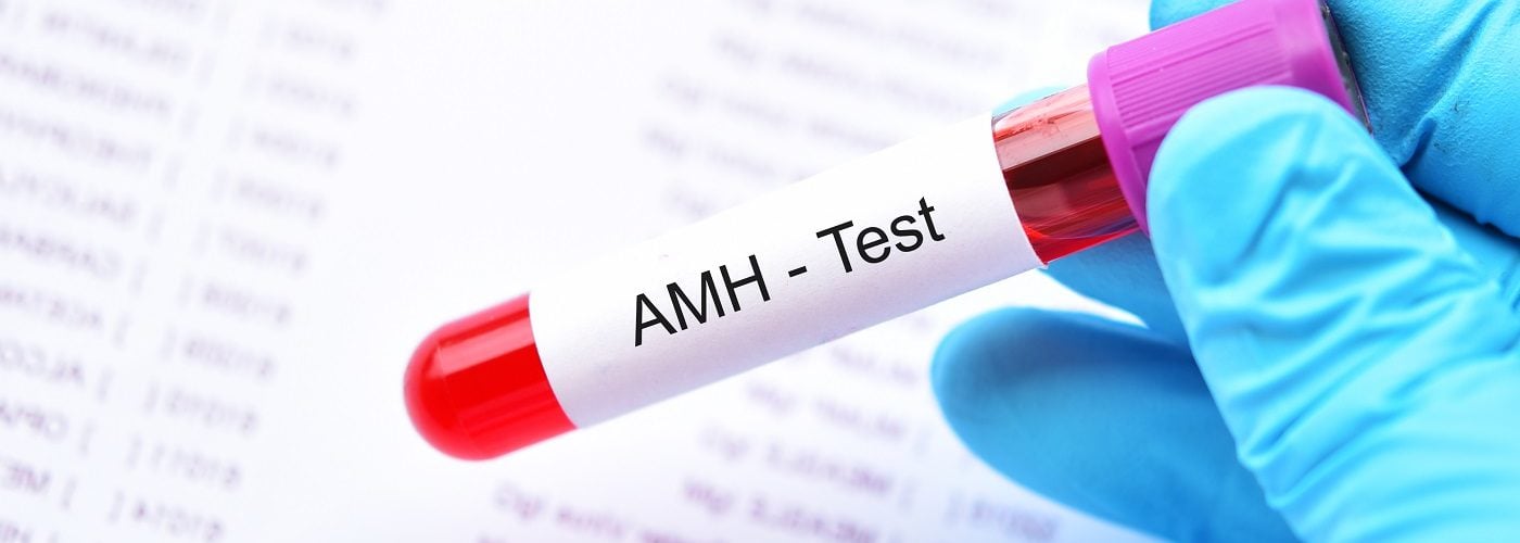 Anti-Mullerian Hormone (AMH)