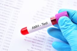 Anti-Mullerian Hormone (AMH)