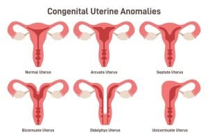 types of uterus