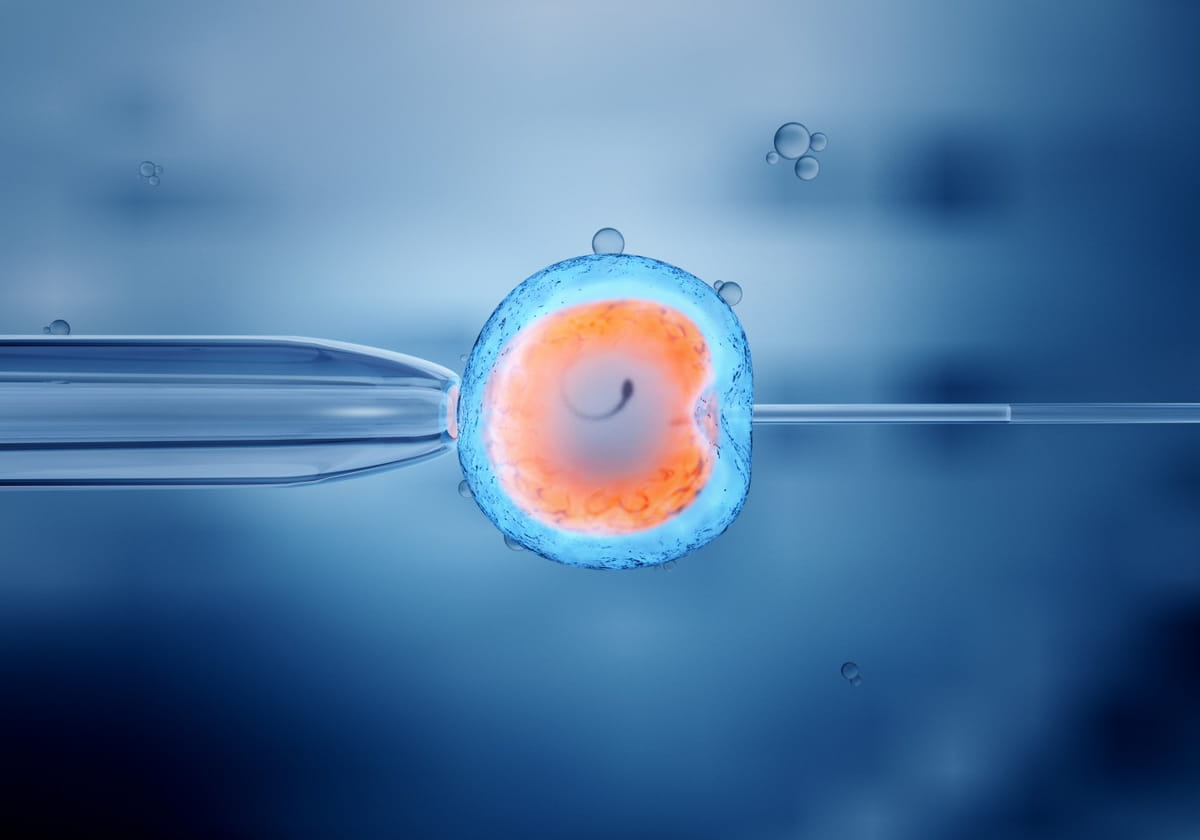 What Is The IVF Process Steps And Different Techniques