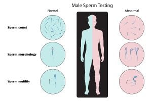 abnormal sperm