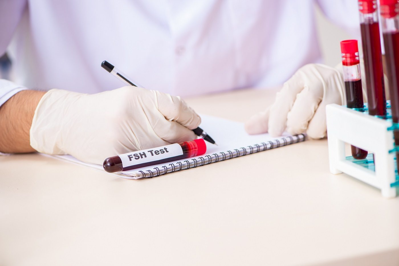 FSH Levels In Men What s This Hormone And How Is It Related To Fertility 