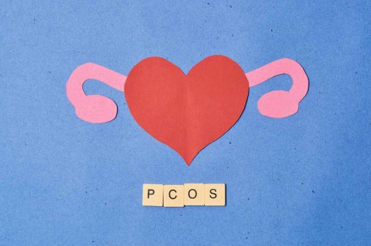 How to track ovulation with PCOS