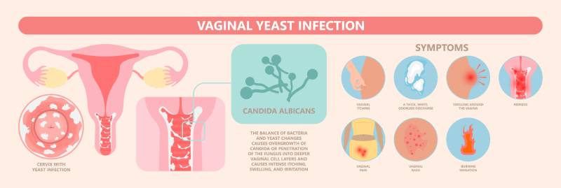 vaginal discharge during pregnancy