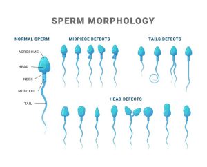 what is sperm morphology 2